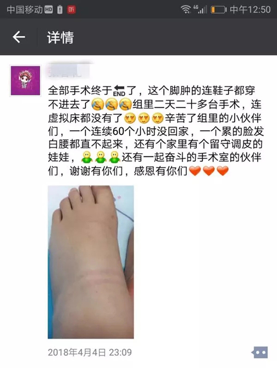 2天做25台手术 妇科医生自拍“大象脚”