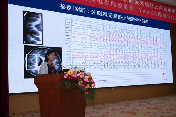 北京大学第一医院刘晓燕为学员授课