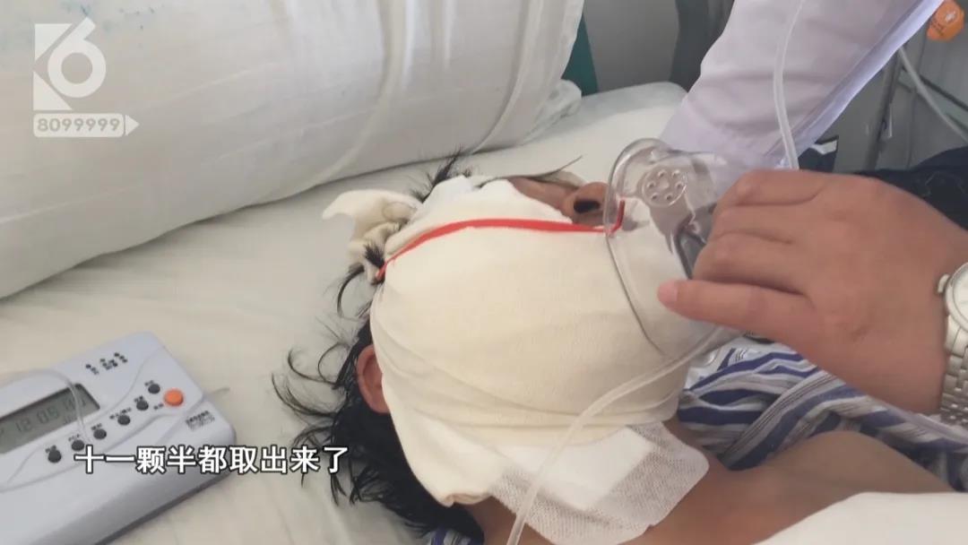 男子脸部被射15.5颗钢珠，竟说是“自己走火”？