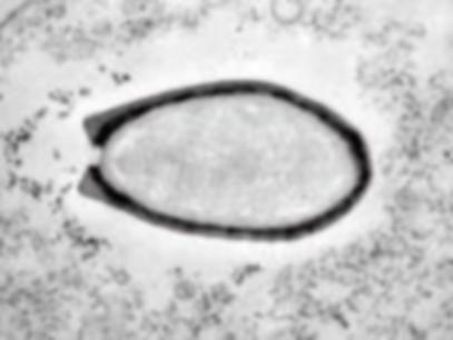 ▲法国科学家复活的一种在西伯利亚永久冻土中冷冻了3万多年的巨型无害病毒