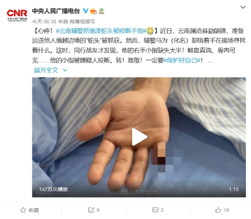 多家央媒为他点赞！普洱一辅警抓偷渡者被咬断手指，他说：还会冲！