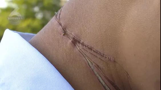 外卖小哥骑车被风筝线“割喉”!